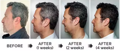 ANCIEN Shampoing Teintant Naturel et Pousse Cheveux