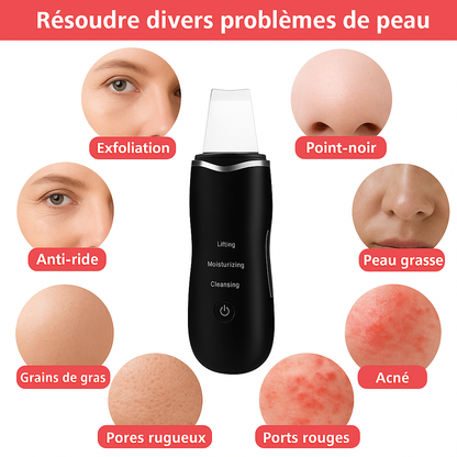 Épurateur de peau ultrasonique – nettoyage en profondeur du visage
