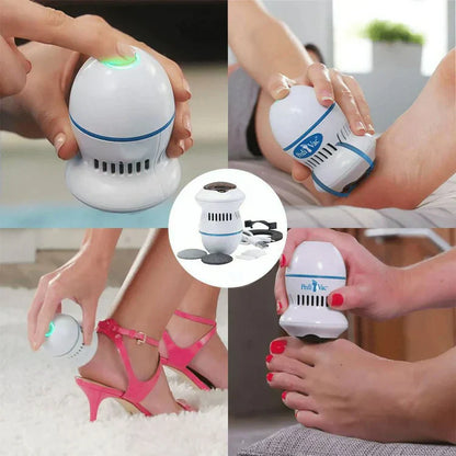 Pedispa™ - Votre solution ultime pour l'élimination des callosités