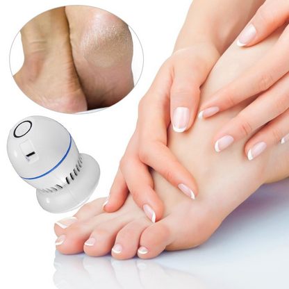 Pedispa™ - Votre solution ultime pour l'élimination des callosités