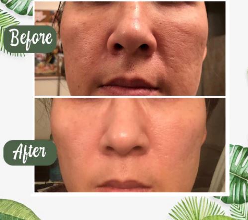 Masque de soins de la peau au thé vert