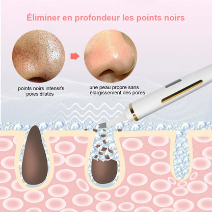 Épurateur de peau ultrasonique – nettoyage en profondeur du visage